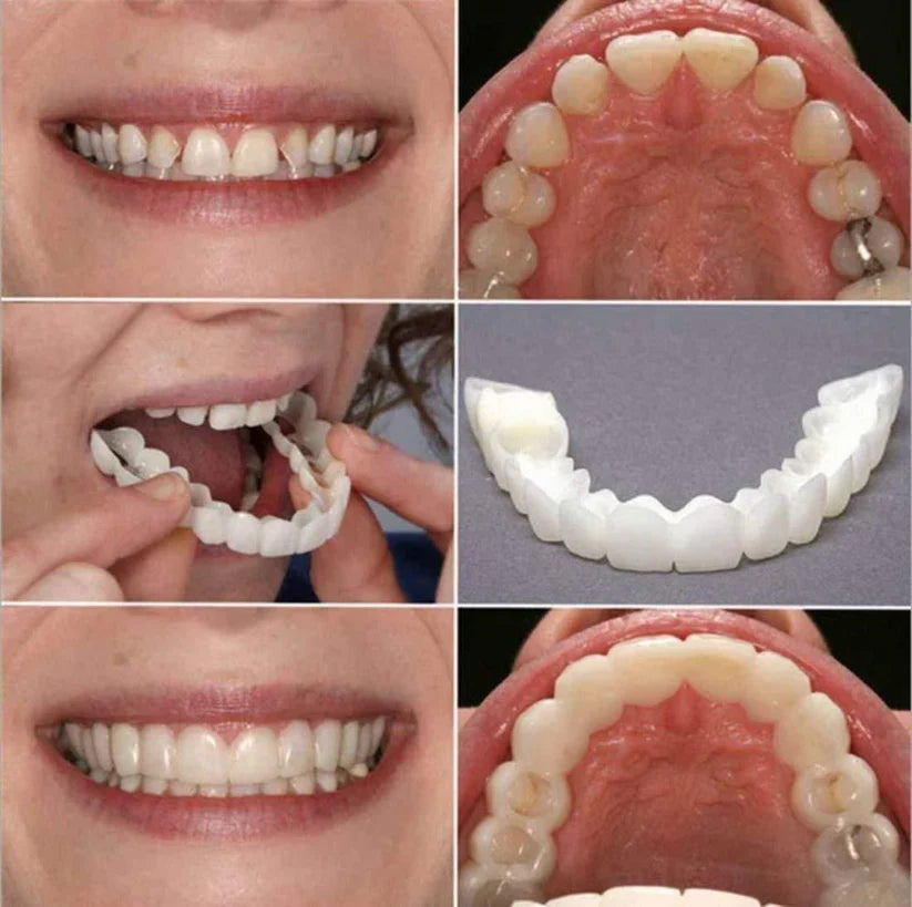 Macadve™ Smile Fit Flex Teeth Denture