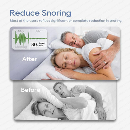 Magnetic Universal Nasal Strip & Clip – Anti-Snoring Breathing Support (PACK OF 2)