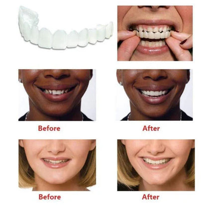 Macadve™ Smile Fit Flex Teeth Denture