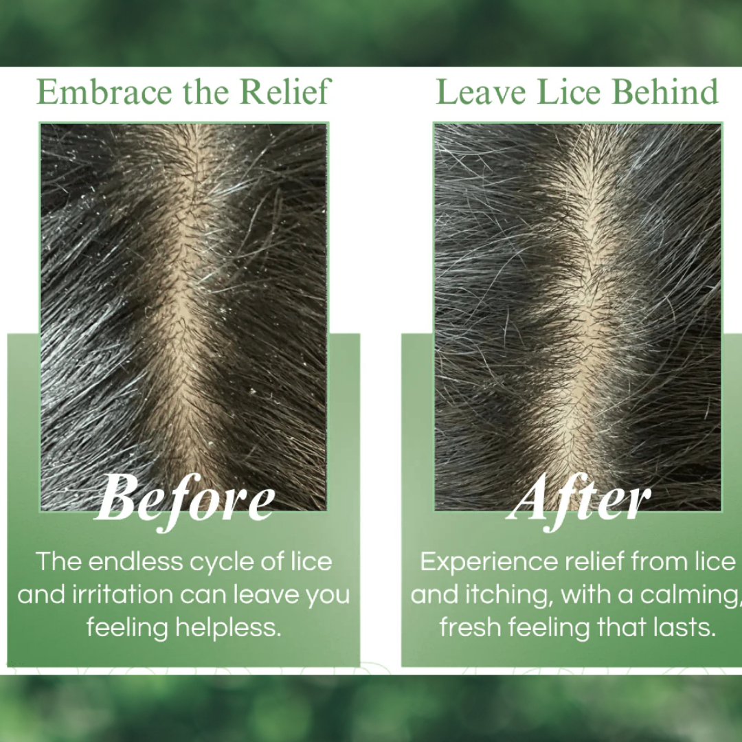 Herbal Anti Lice & Nits Shampoo with Free Neem Comb